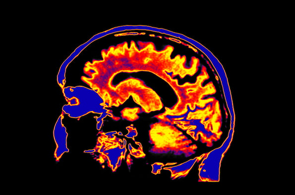 接触点 - 脑扫描压力和技术