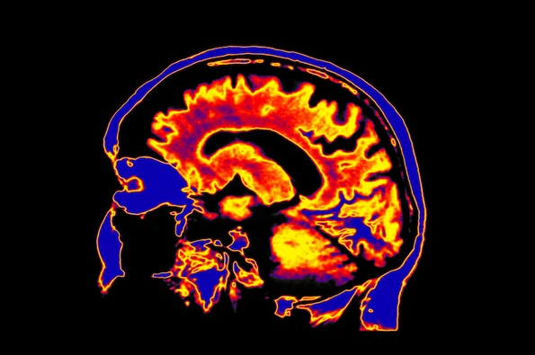 touchpoints-brain-scan-stress-and-tech